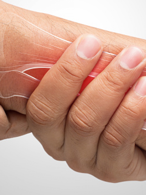 Zo ontstaat de ziekte van De Quervain